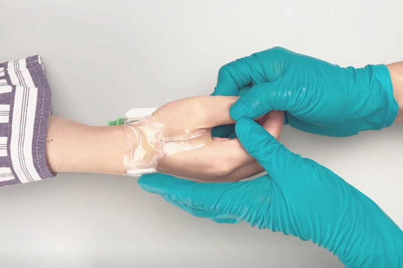 Why are hemostatic devices replacing manual compression
